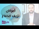 أعراض نزيف الدماغ وعلاجه