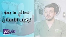 نصائح ما بعد تركيب الأسنان