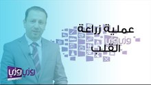 عملية زراعة القلب