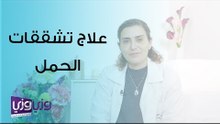 علاج تشققات الحمل