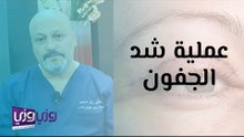 عملية شد الجفون العليا والسفلى ومخاطرها