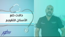حالات خلع الأسنان للتقويم