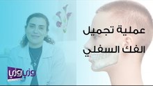 عملية تجميل الفك السفلي