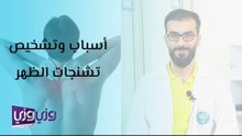 أسباب وتشخيص تشنجات الظهر