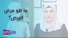 ما هو مرض البرص؟