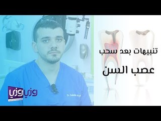 تنبيهات بعد سحب عصب السن