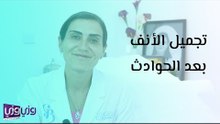 تجميل الأنف بعد الحوادث