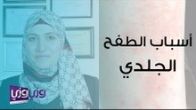 أسباب الطفح الجلدي وعلاجه