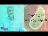 علاج حصوات المرارة بدون جراحة