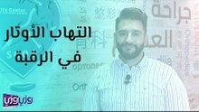 أعراض وأسباب التهاب الأوتار في الرقبة