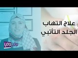 علاج التهاب الجلد التأتبي