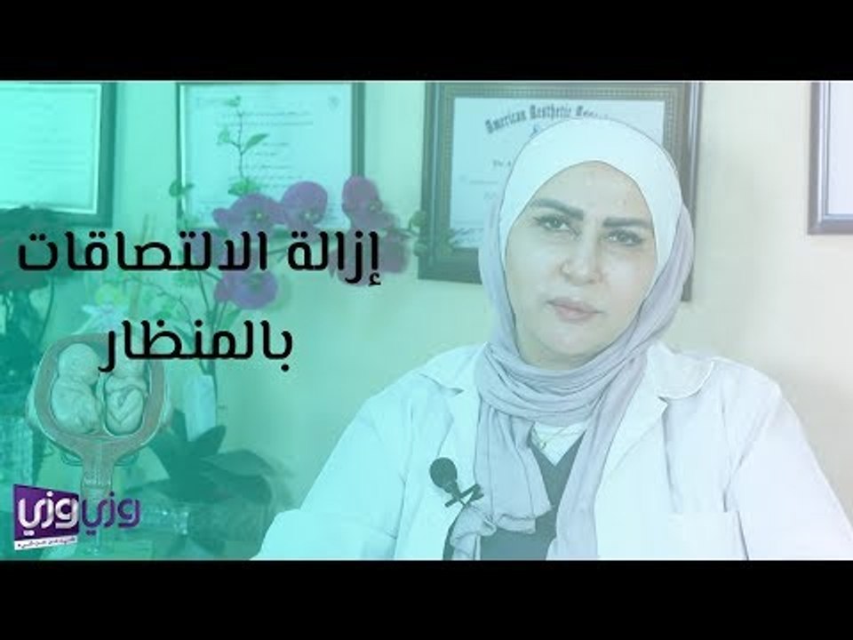 إزالة الالتصاقات بالمنظار