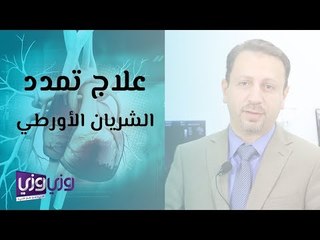 علاج تمدد الشريان الأورطي
