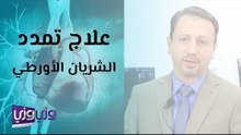 علاج تمدد الشريان الأورطي