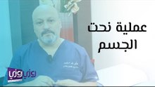 عملية نحت الجسم