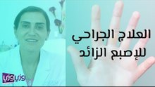 العلاج الجراحي للإصبع الزائد