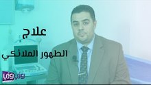 أسباب وعلاج الطهور الملائكي
