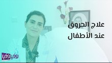 علاج الحروق عند الأطفال
