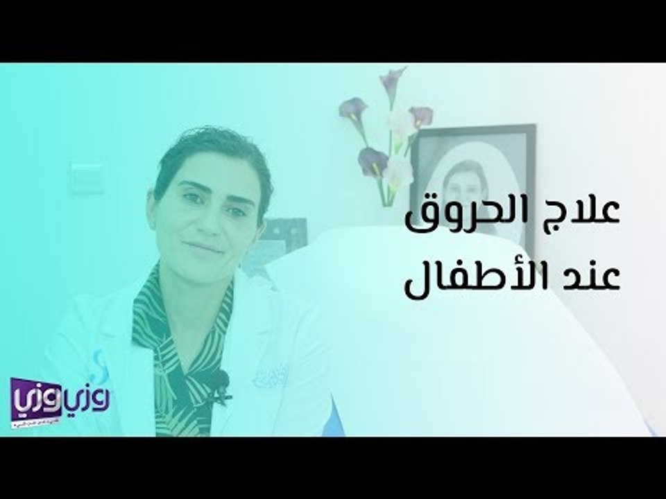علاج الحروق عند الأطفال