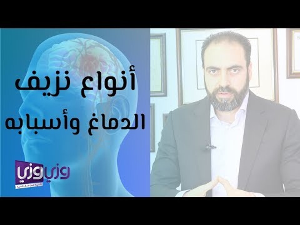 أنواع نزيف الدماغ وأسبابه