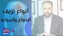 أنواع نزيف الدماغ وأسبابه
