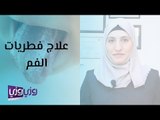 علاج فطريات الفم وأهم أسبابها