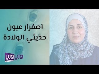 اصفرار العين عند الاطفال حديثي الولادة