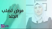 مرض تصلب الجلد