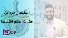 استئصال جزء من فقرات الظهر القطنية
