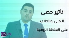 تأثير حصى الكلى والحالب على العلاقة الزوجية