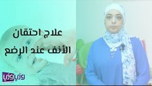 علاج احتقان الأنف عند الرضع