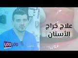 علاج خراج الأسنان