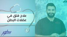 علاج الفتق في عضلات البطن