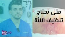 متى نحتاج تنظيف اللثة؟