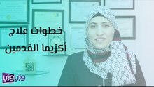 خطوات علاج إكزيما القدمين
