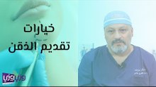 خيارات تقديم الذقن