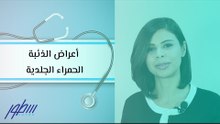 أعراض الذئبة الحمراء الجلدية