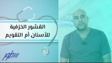 القشور الخزفية للأسنان أم التقويم