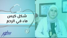 شكل كيس ماء في الرحم