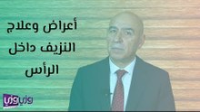 أعراض وعلاج النزيف داخل الرأس