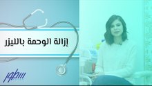إزالة الوحمة بالليزر