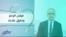 ميلان الرحم وطرق علاجه