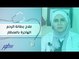 علاج بطانة الرحم الهاجرة بالمنظار