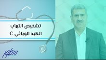 تشخيص التهاب الكبد الوبائي C