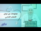 معلومات عن مرض التصلب الحدبي