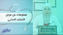 معلومات عن مرض التصلب الحدبي