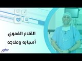 القلاع الفموي أسبابه وعلاجه