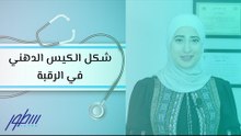 شكل الكيس الدهني في الرقبة