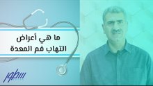 ما هي أعراض التهاب فم المعدة