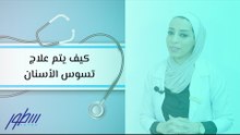 كيف يتم علاج تسوس الأسنان